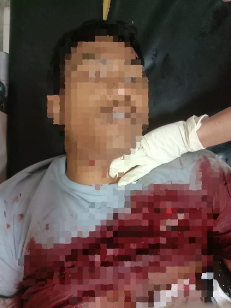Ungkap Kasus Pembacokan di Ketapang, Polisi : Pelaku Sakit Hati Karena di Tampar